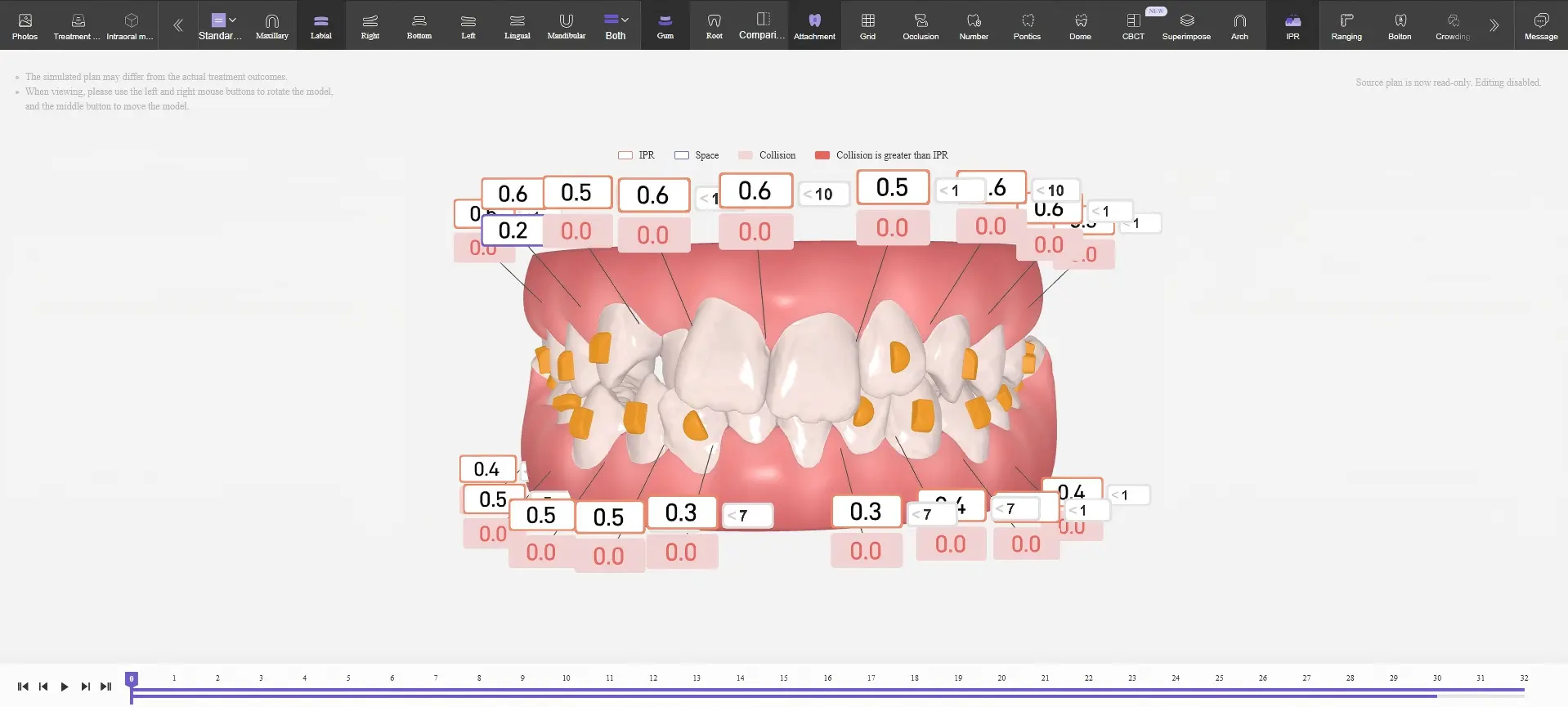 Best-Smile-Tech-AI-clear-aligner-design-software-platform